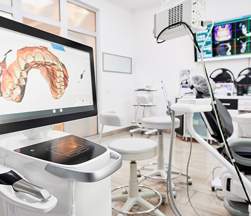 Digital impression of a patient's teeth on a chairside monitor