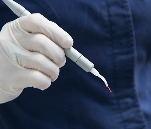 Dental professional holding a laser pen device