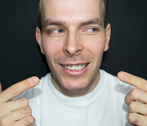 Man with braces pointing to his smile