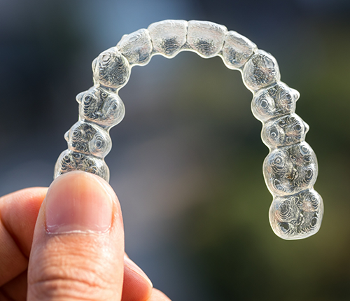 Hand holding a Spark clear aligner