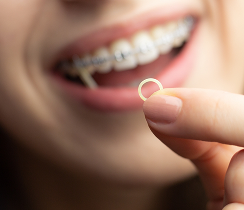 Person with braces holding a small elastic band