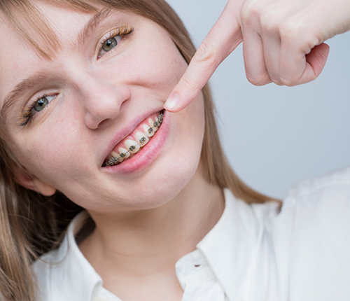 Girl with traditional braces pointing to her smile
